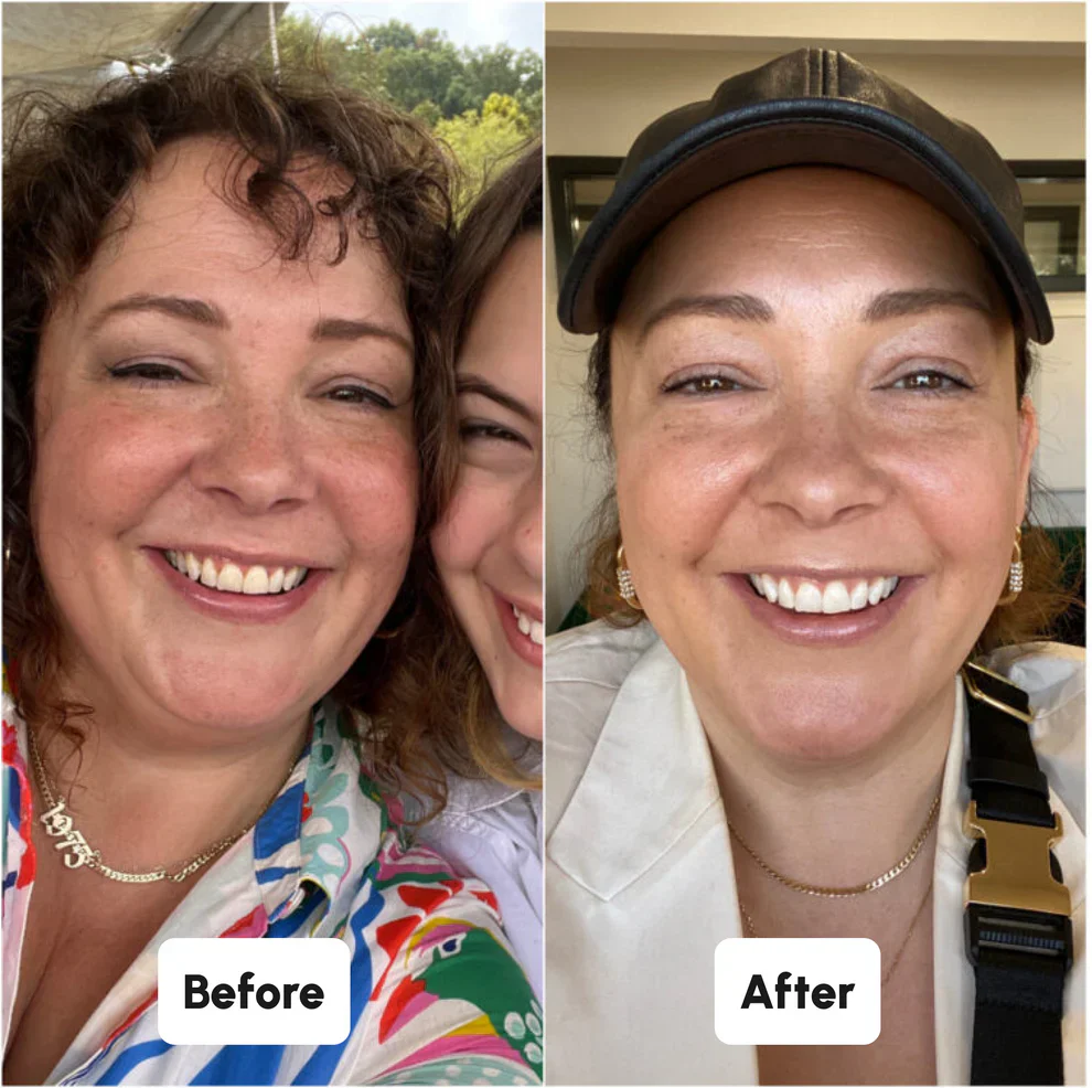 Spearmint Oil Pulling Rinse - Image 4