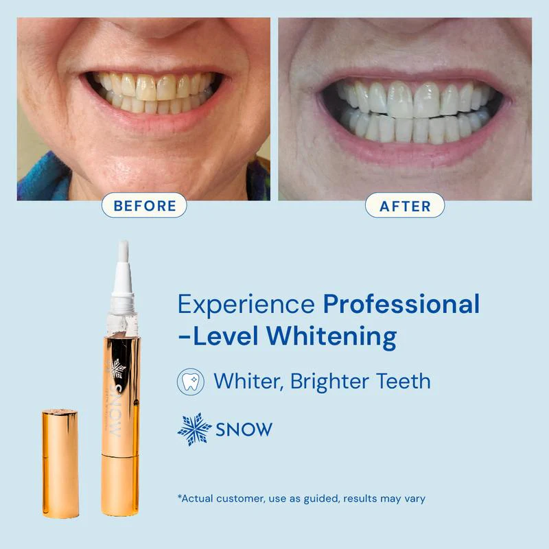 Teeth Whitening Serum Pen - Image 4